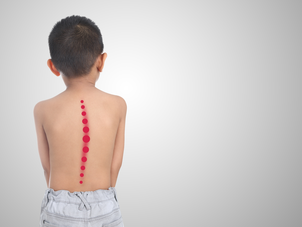 Child with a spine misalignment - Chiropractic Care: Benefits Across Different Age Groups